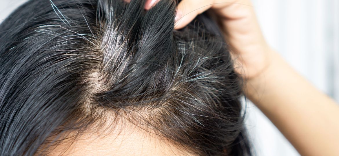 Closeup,Asian,Woman,Having,Problem,With,Grey,,White,Hair,Growing